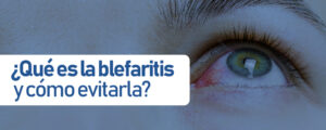 blefaritis