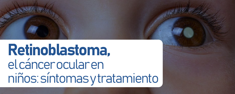 Retinoblastoma, el cáncer ocular en niños: síntomas y tratamiento