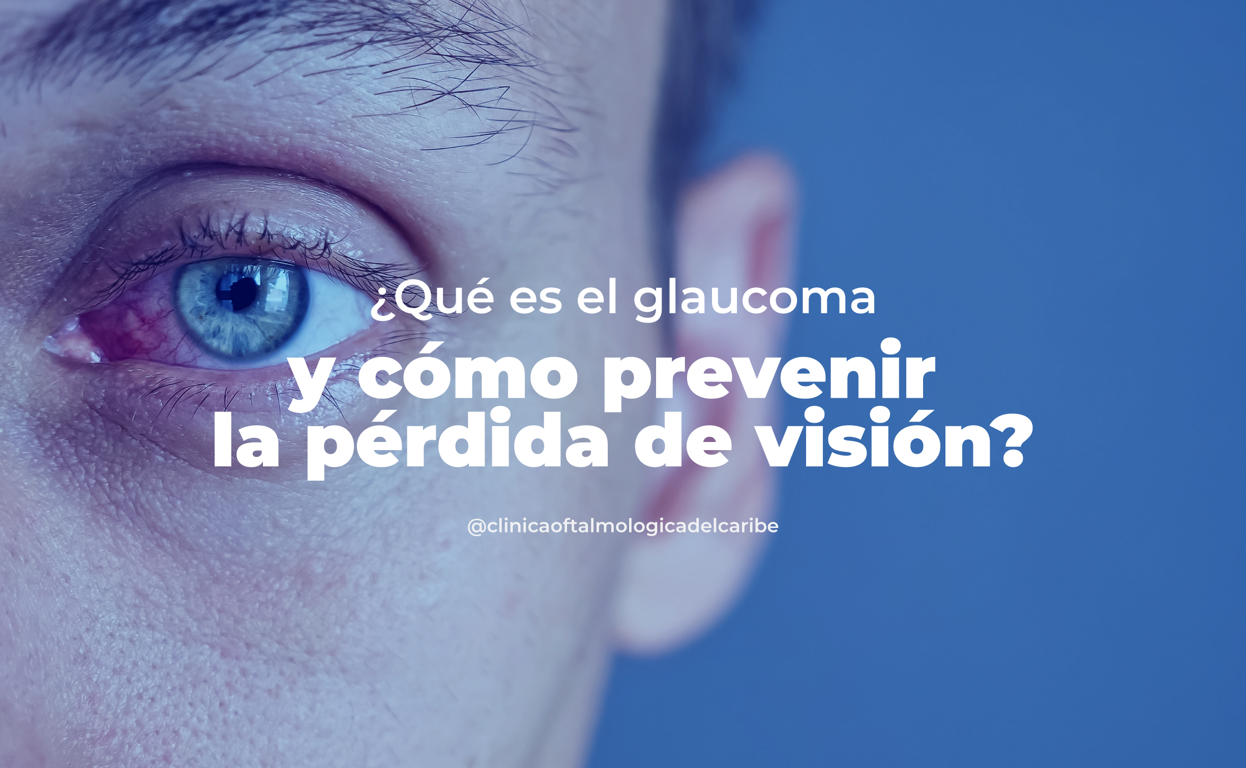 Glaucoma: detección temprana con exámenes regulares, control de presión ocular, dieta antioxidante, ejercicio, protección solar y evitar el tabaco